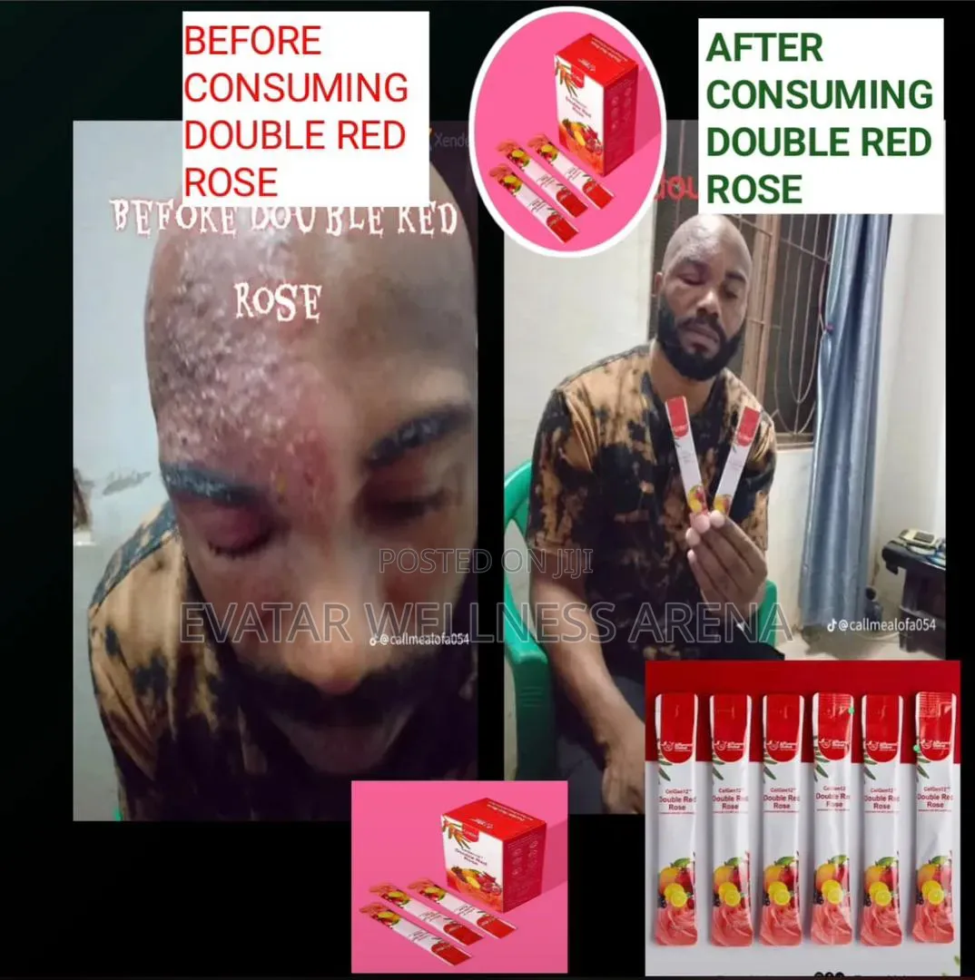 Double Red Rose