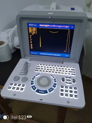 Tabletop Ultrasound Machine