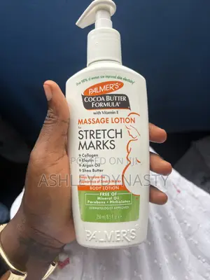 Effective Stretchmark Lotions