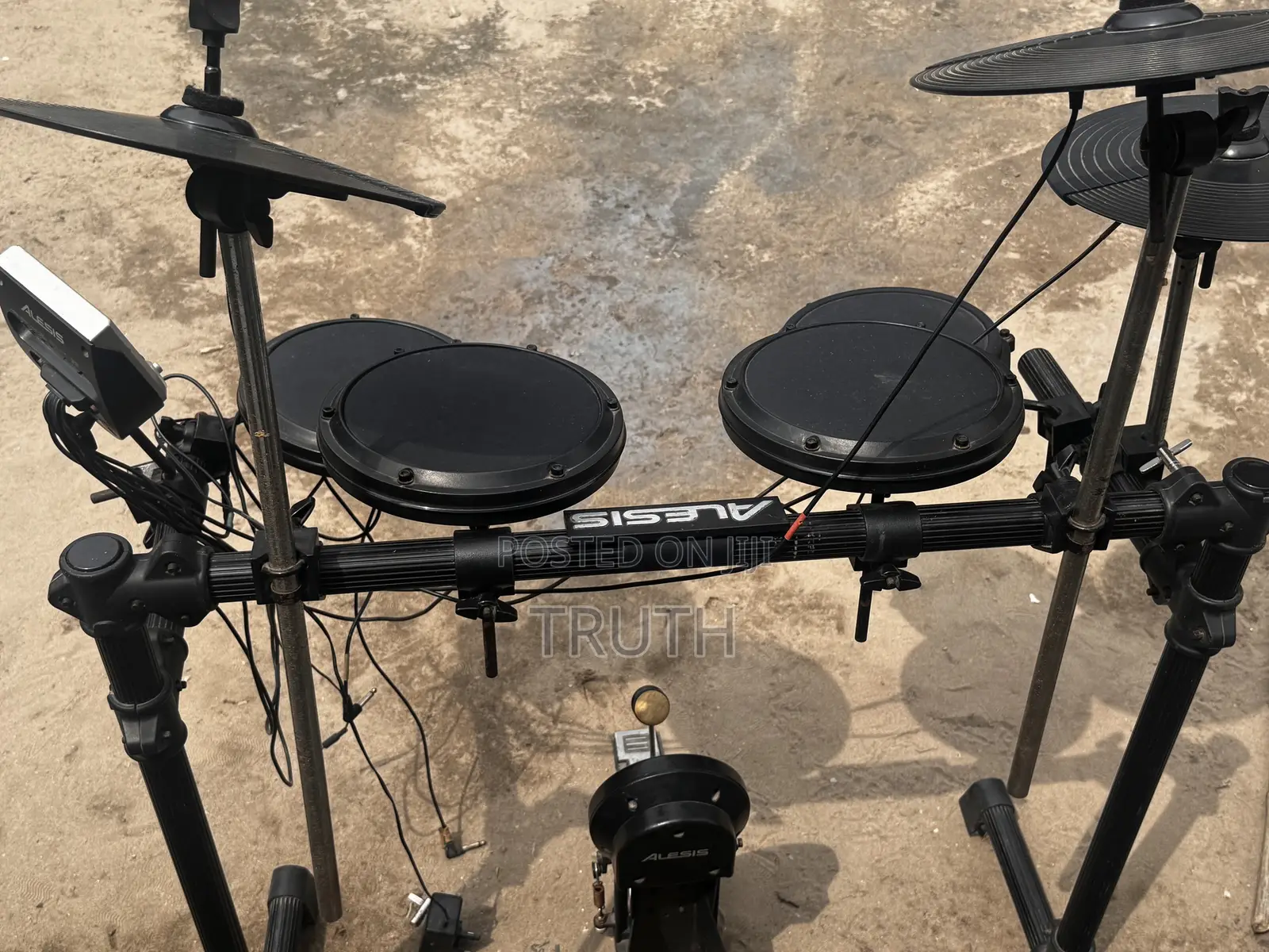 Alesis Electronic Drum Kit — Complete Set