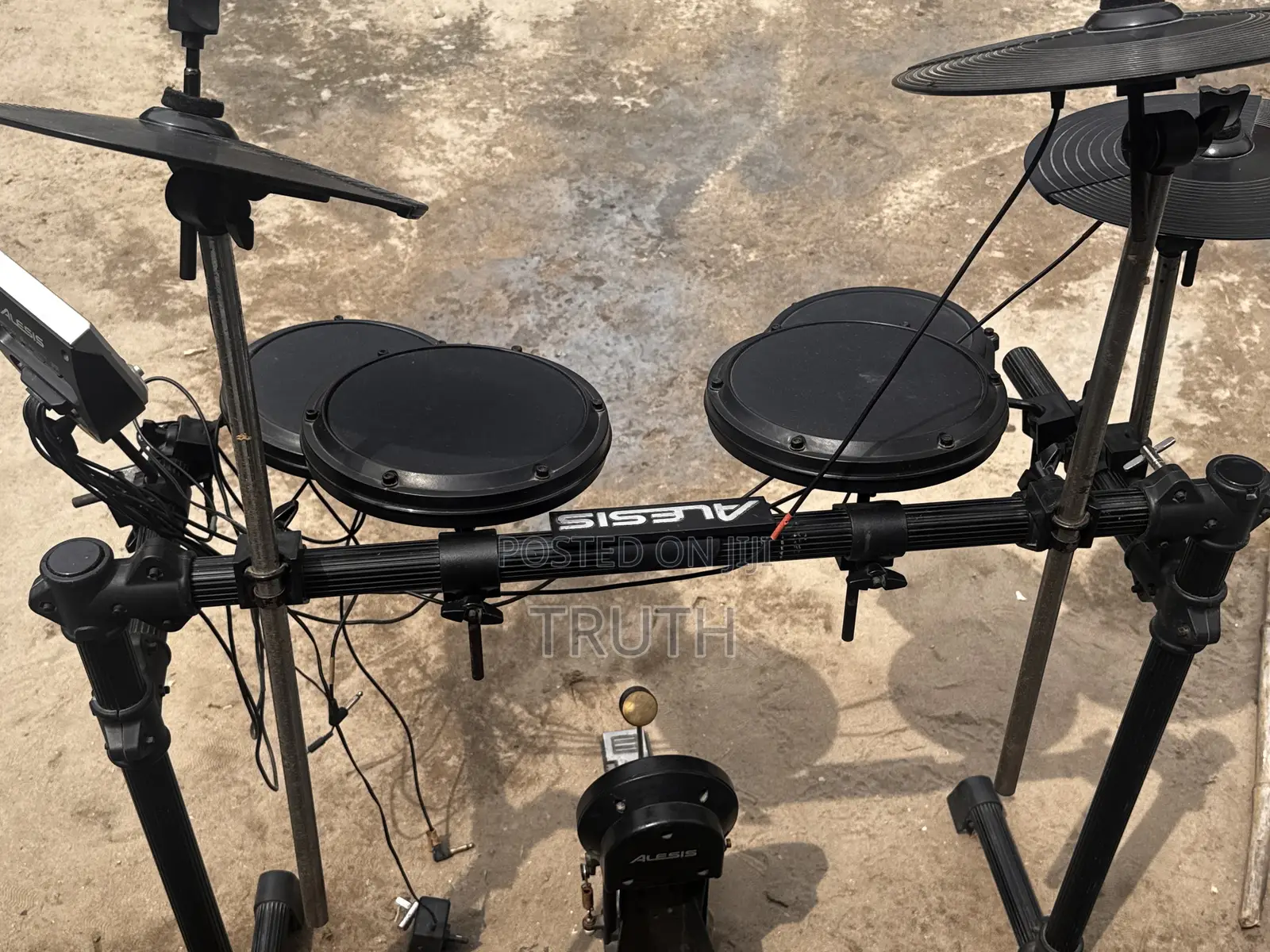 Alesis Electronic Drum Kit — Complete Set