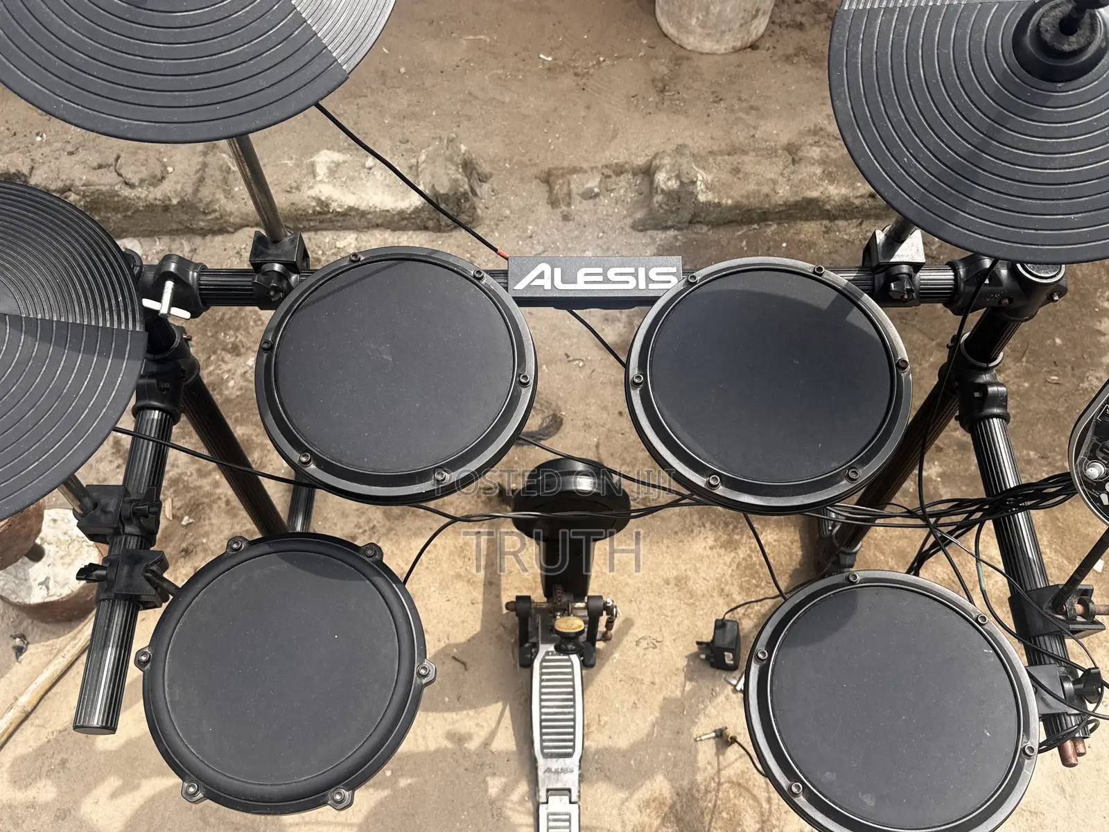 Alesis Electronic Drum Kit — Complete Set