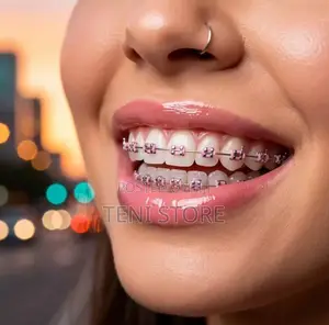 Tooth Braces