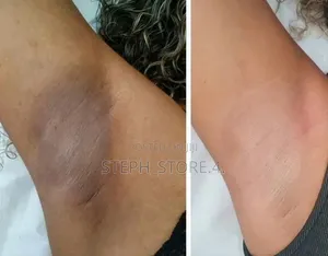 Exfoliating Body