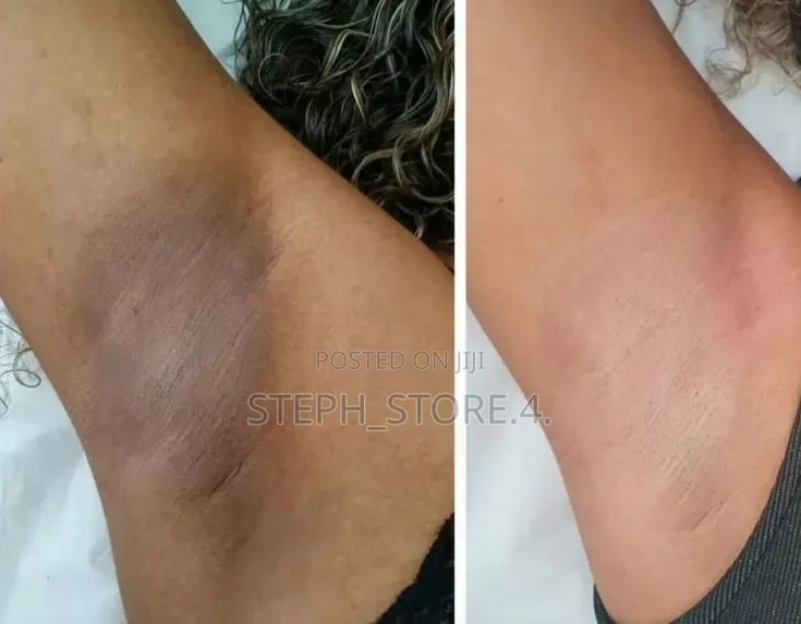 Exfoliating Body
