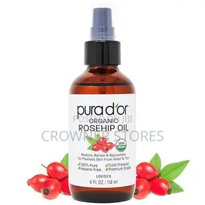 PURA d'OR ORGANIC Rosehip Seed Oil Pure Cold-Pressed for Face, 4oz