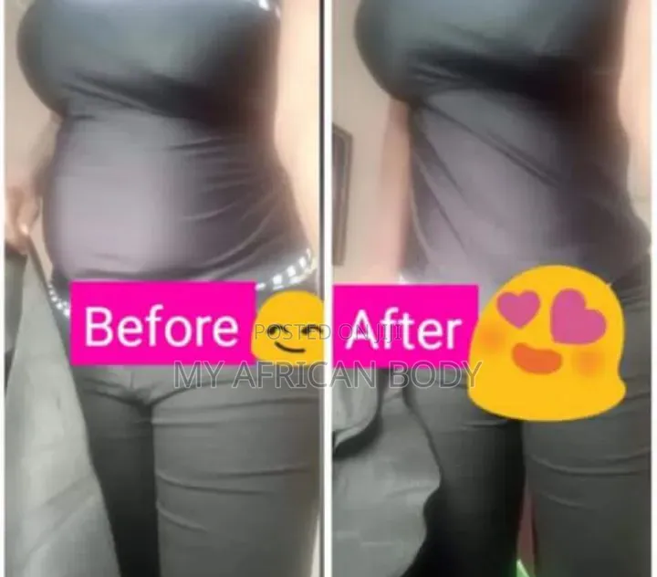 Tummy Wrap Waist Trainer