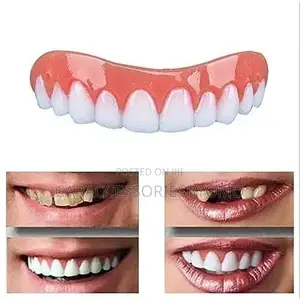 Perfect Smile Veneers