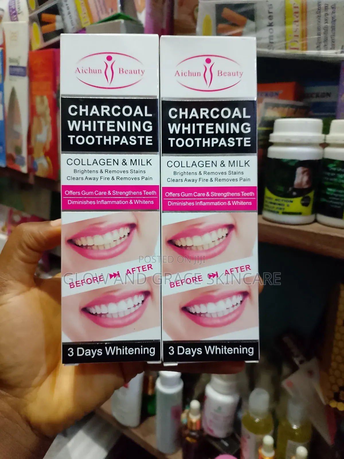 Charcoal Teeth Whitening