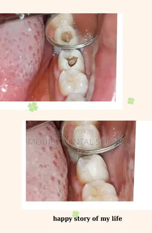Dental Treatment