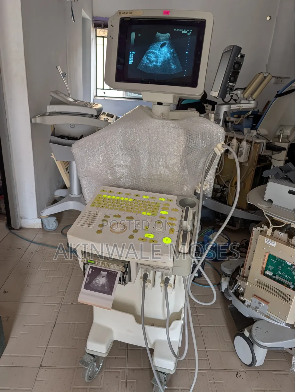 Ultrasound Machine