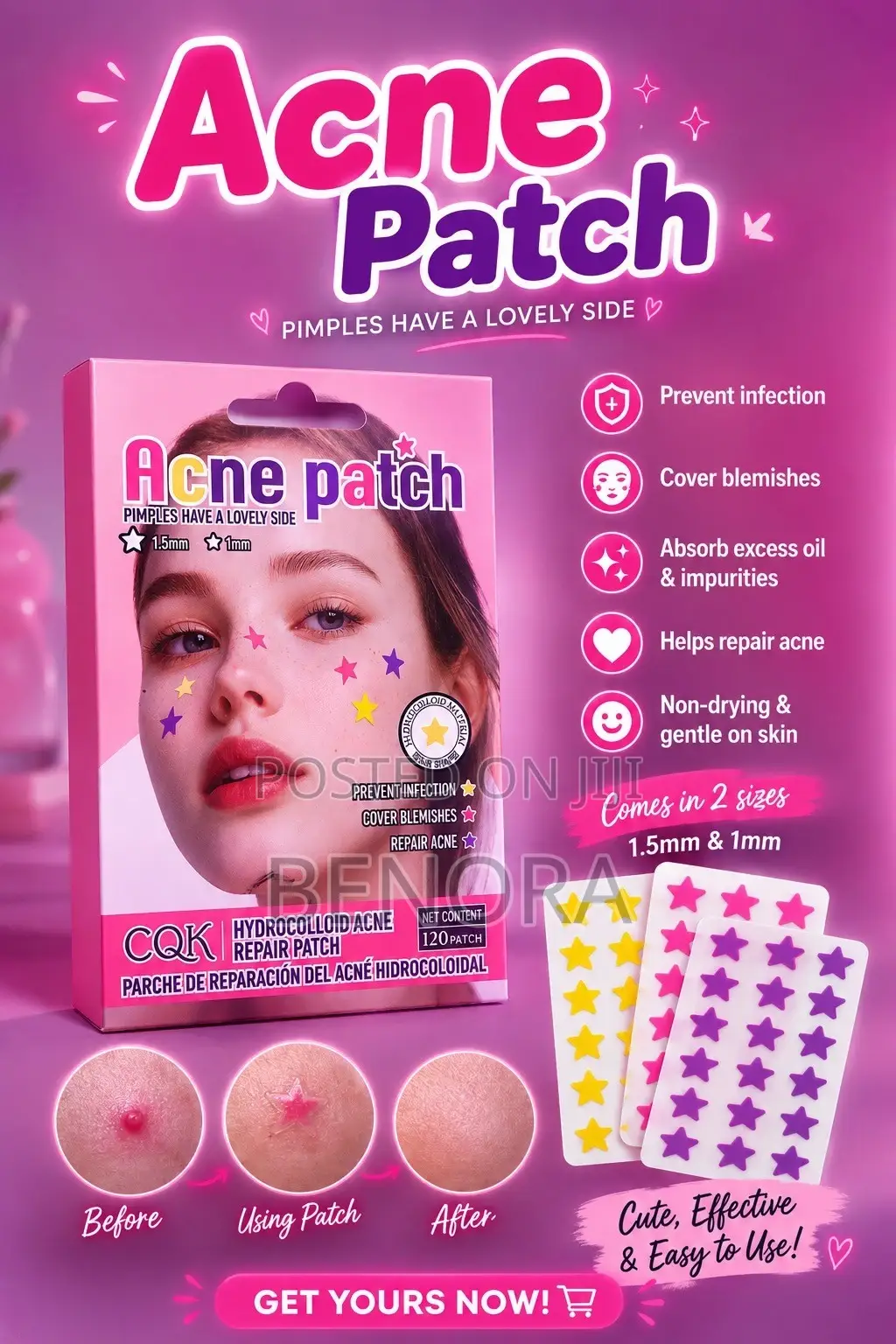 It’s Helps Heal Ur Acne