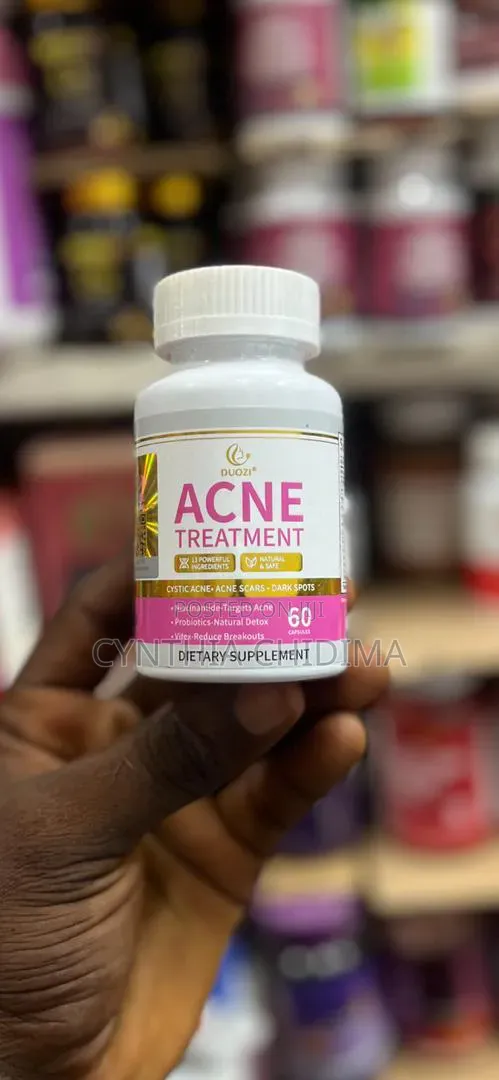 Acne Treatment