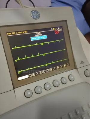 Ge Mac 3500 ECG Machine (12 Channel)