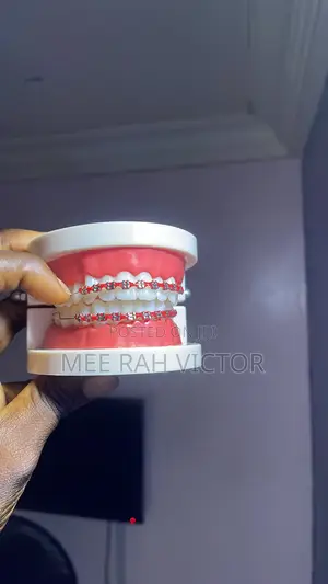 Brand New Fashion Braces Grillz