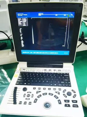 Ultrasound Scanner
