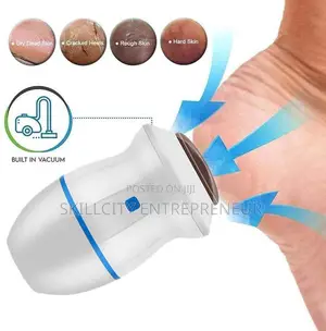 Moisturize Callus Remover