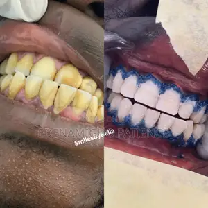 Professional Dental Aesthetic Services in BeninCity