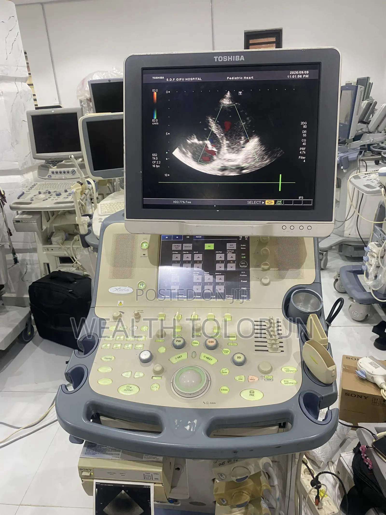 Ultrasound