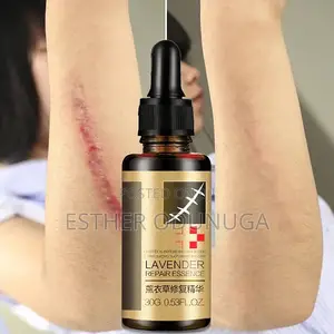 Skin Lavender Repair Oil for Scars Stretch Mark