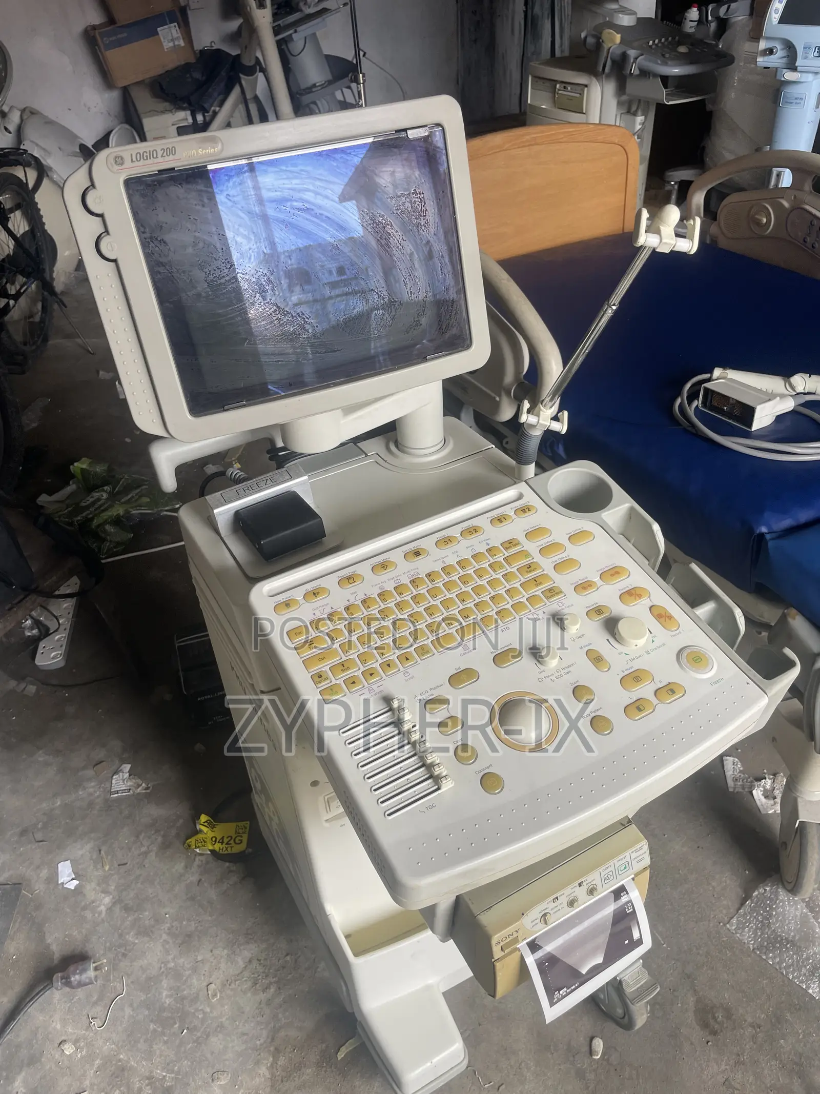 Ultrasound Scan Machine