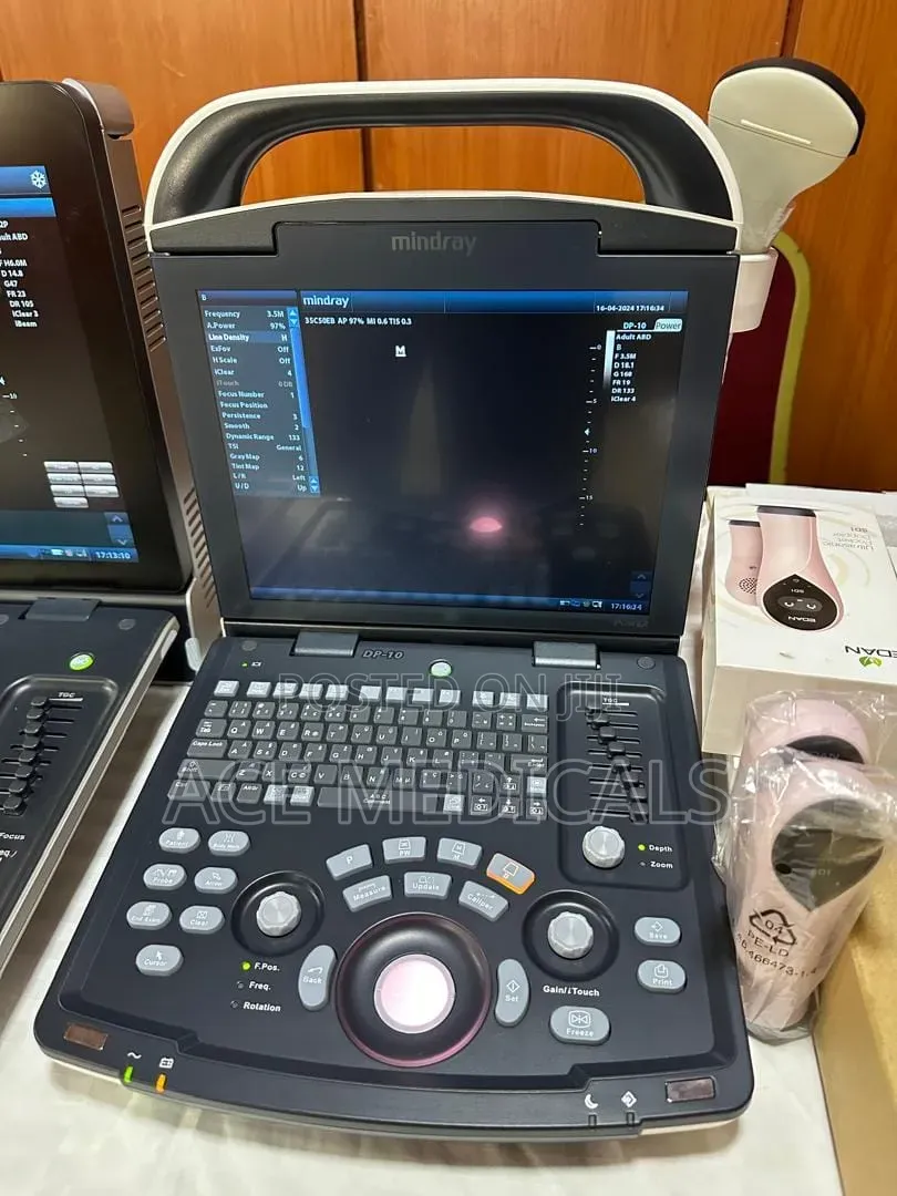 Mindray DP10 Ultrasound Scanner