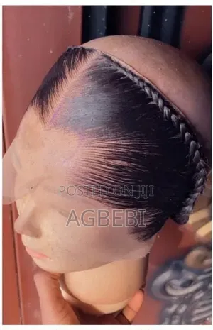 Dara_hairline
