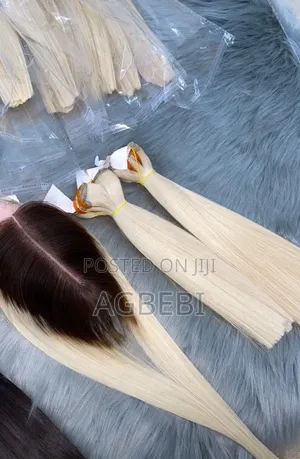 Dara_hairline