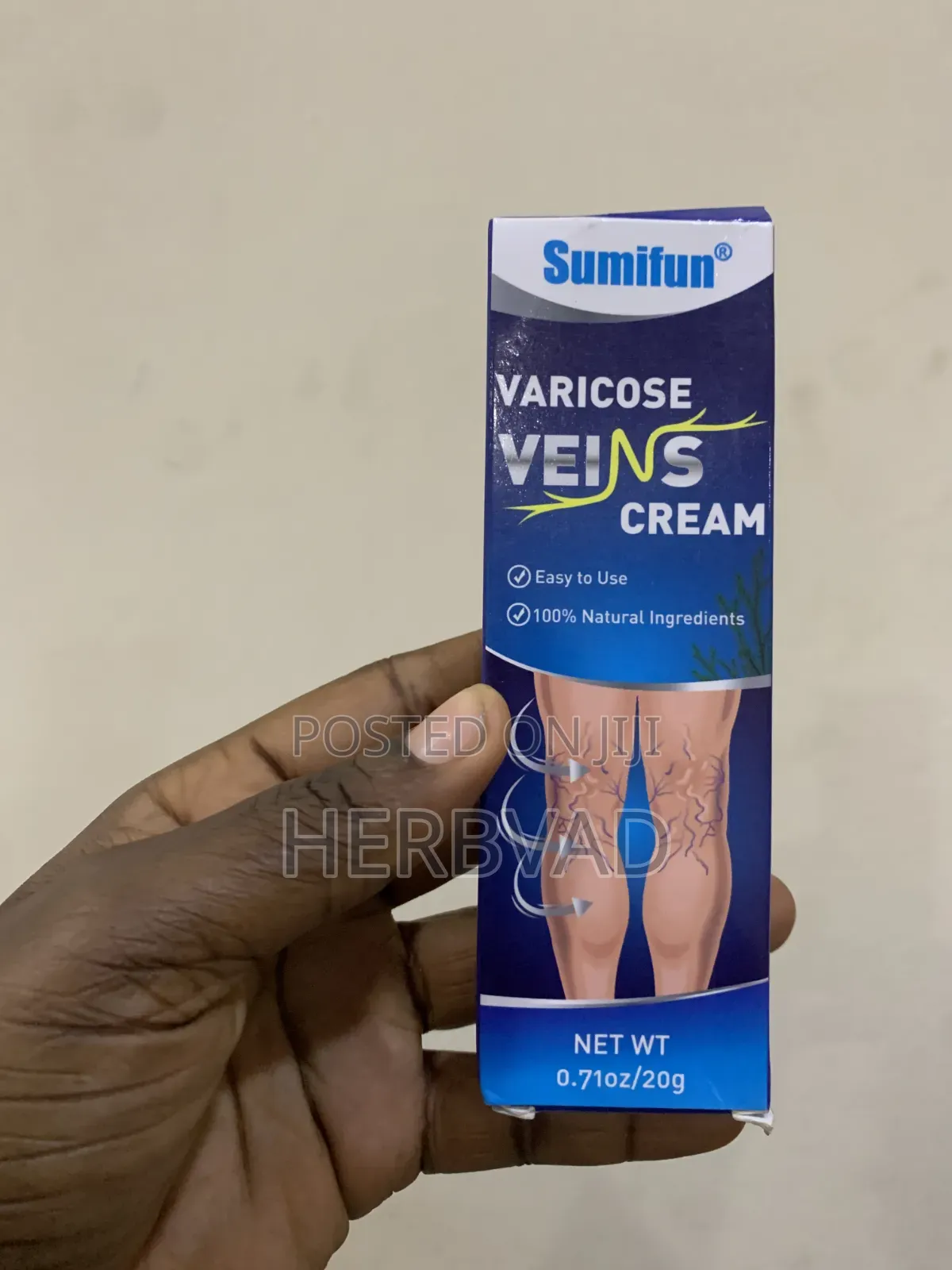 Varicose Veins Cream