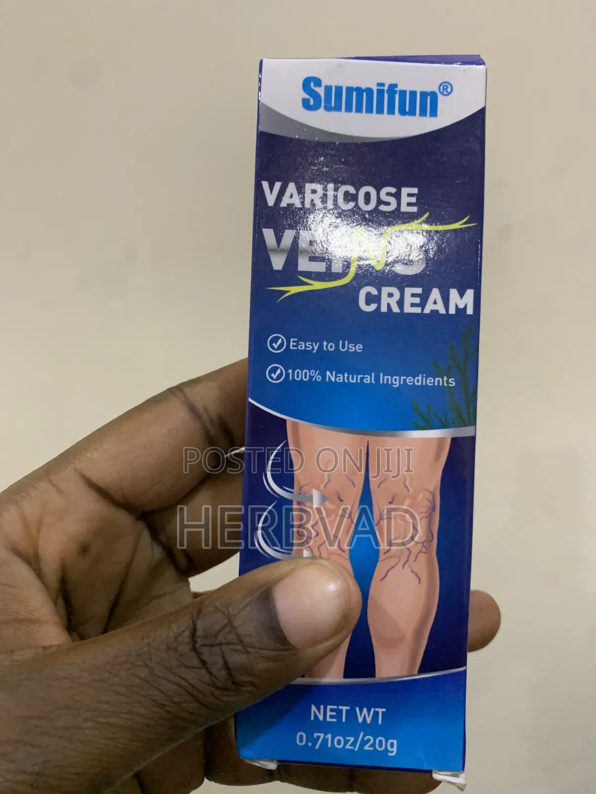 Varicose Veins Cream