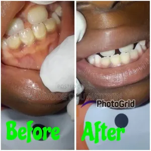 50% Discount Scaling and Polishing