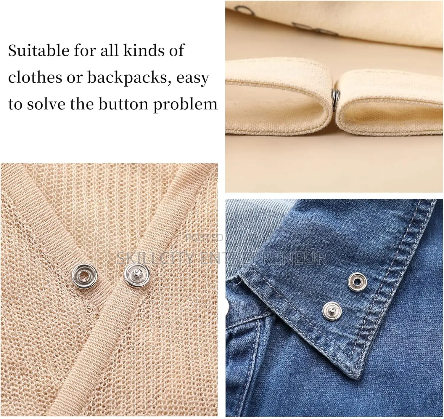 Snap Button Kit