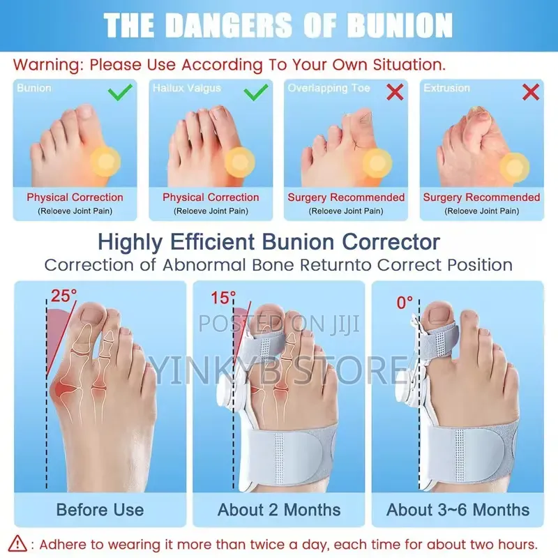 Bunion Corrector