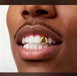 Gold Teeth