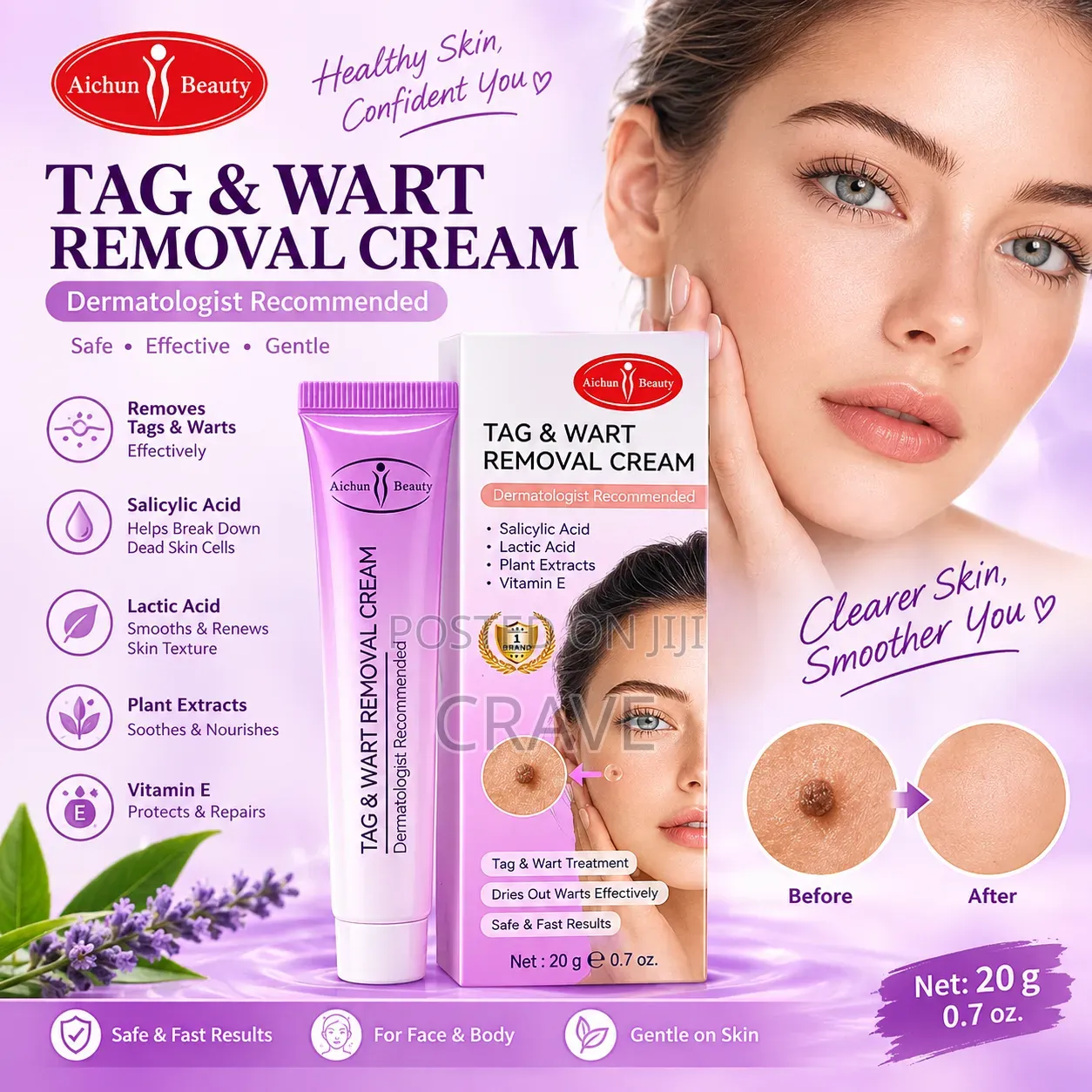 Aichun Beauty Tag Wart Removal Cream – 20g