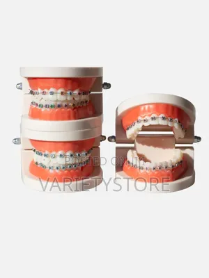 Dental Orthodontic Teeth Model With Colorful Braces