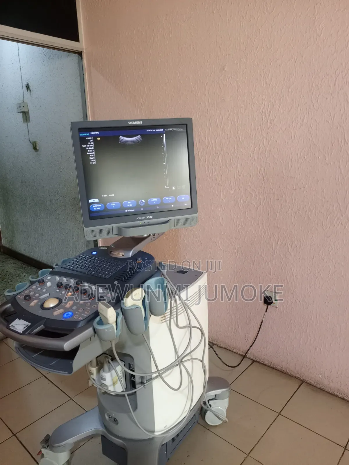 Acuson X300 Ultrasound Machine