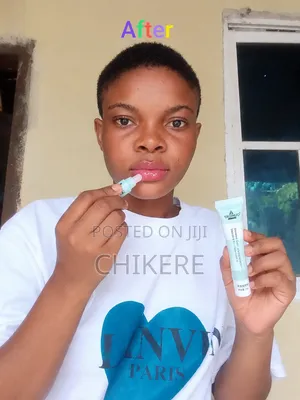 Pink Lips Vaseline Essence