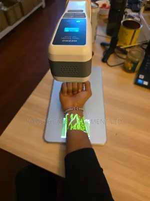 Hepho Vein Finder
