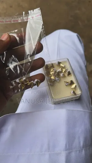 Gold Teeth