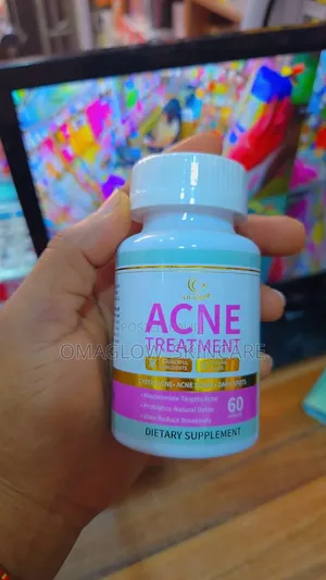 Douzi Acne Treatment