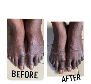 Mobile Pedicure & Home Service – Classic, Jelly & Paraffin Foot Care
