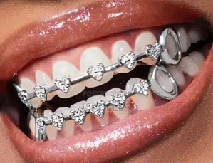 Teeth Charms