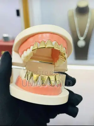Gold Teeth