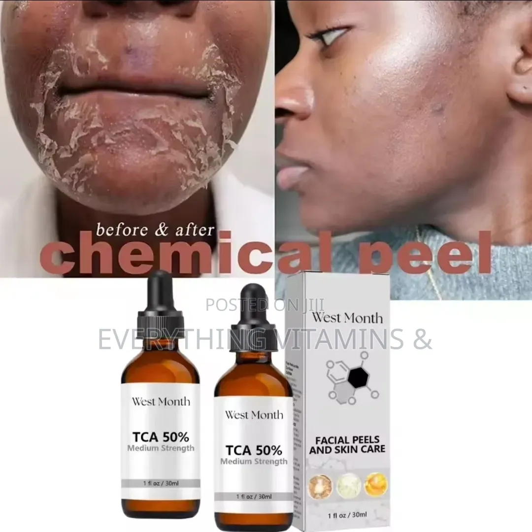 West Month TCA 50% (Medium Strength)