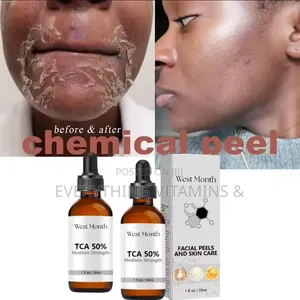 West Month TCA 50% (Medium Strength)