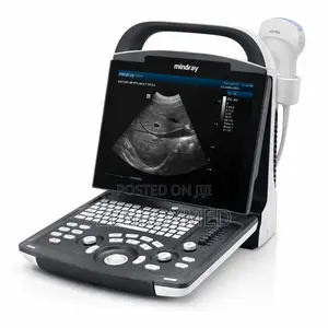 Mindray DP10 Portable Ultrasound System (1 Probe Included)