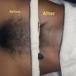 Waxing Treatment