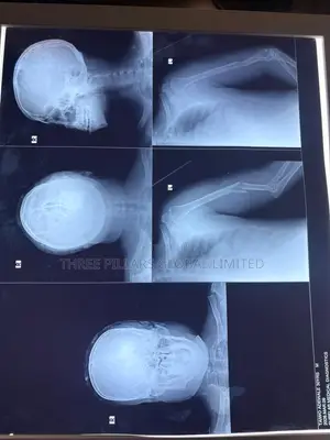 X-Ray View Box