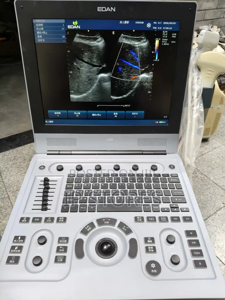Utrasound Machine